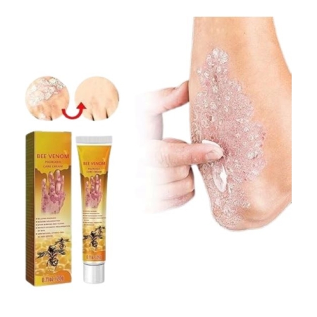 PROFESJONALNY krem do leczenia na ŁUSZCZYCĘ swędzenie z JADEM PSZCZELIM 20g